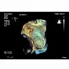 Ультразвуковой аппарат Philips EPIQ CVx 