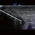Клиническое изображение Ультразвуковой аппарат Mindray М6 