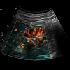 Ультразвуковой аппарат GE Healthcare Vivid S70 